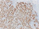 3580B | Control Slides:Immunopathology; Melan-A (MART-1)